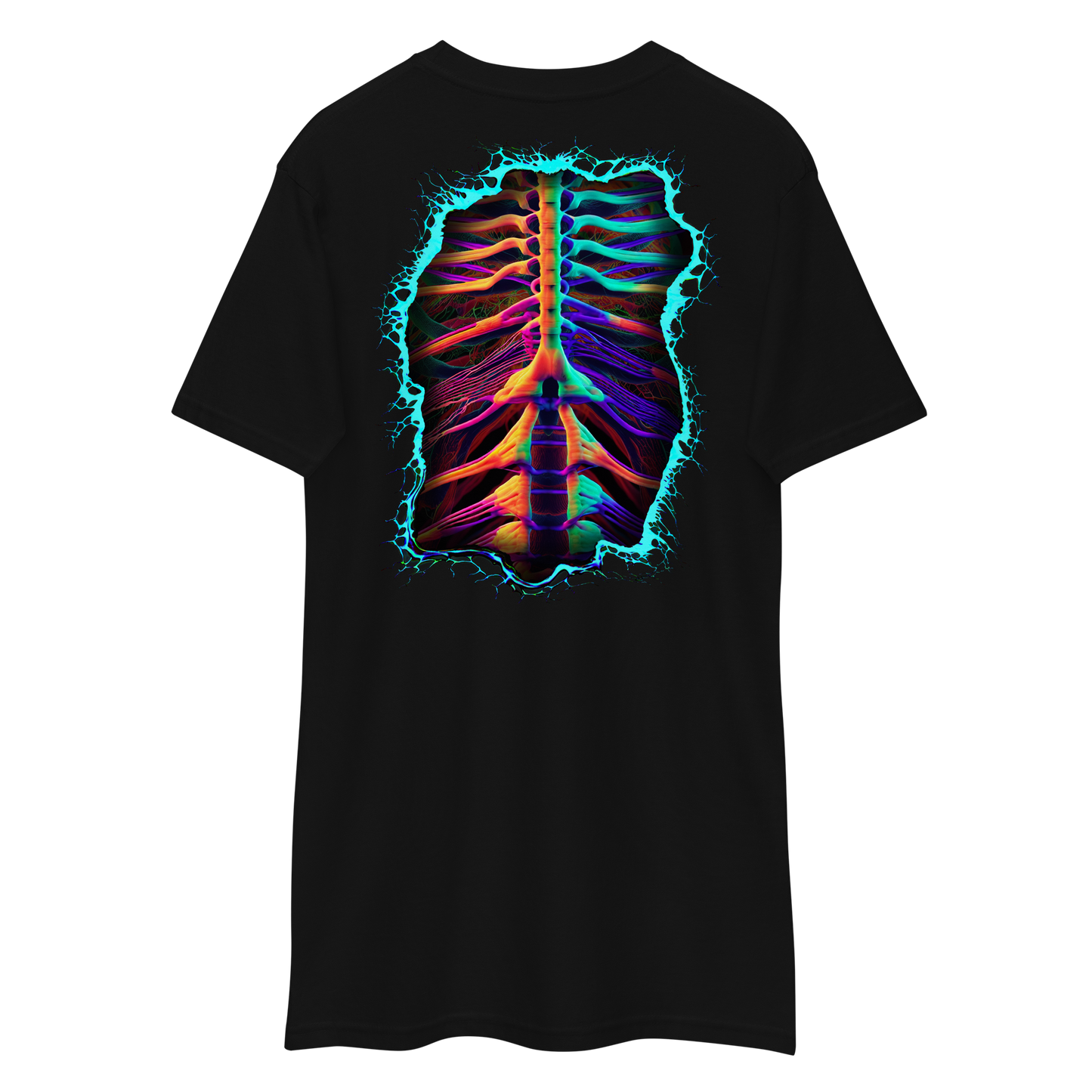 X-RAY